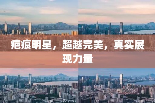 疤痕明星，超越完美，真實展現(xiàn)力量